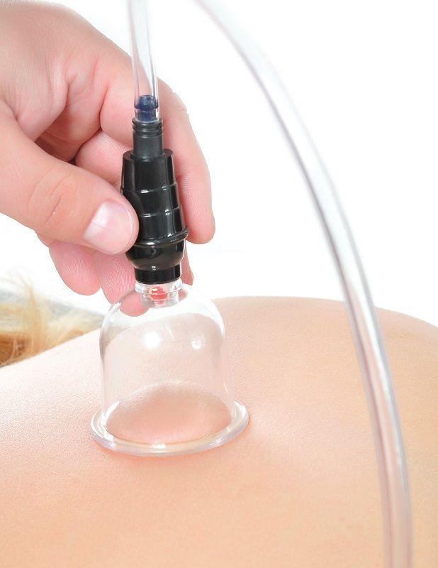 Cupping Vacuum Cup Set - Bankovanie - Vakuova Pumpa 4